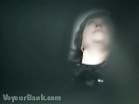 Подглядывание в гинекологии через жалюзи